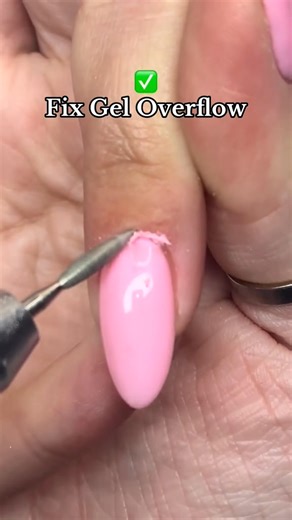1.7M views · 6.5K reactions | How to fix gel overflow without having...