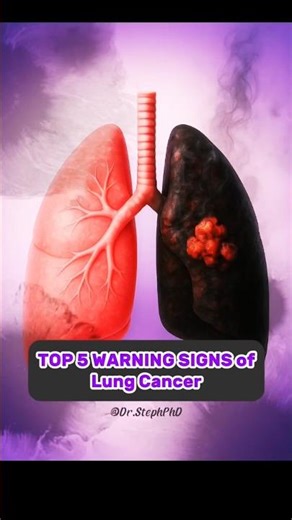 🚨5 WARNING SIGNS of Lung Cancer | Lung Cancer Awareness Month