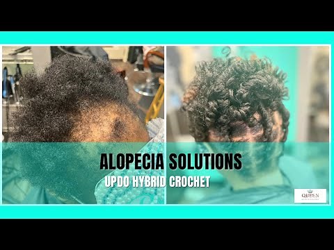 Achieving Stunning Updo Styles for Alopecia: Curly Crochet No-Glue Techniques