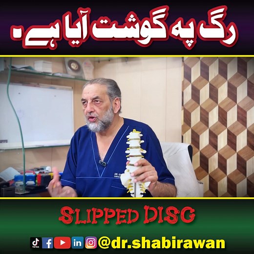 Slipped Disc Explained | Meat Pressing on Nerve | Dr. Shabir Awan | Spine & Orthopedic Specialist Dr. Shabir Awan explains the condition commonly known as “Rag pe gosht aaya hai” — a slipped or herniated disc pressing on the spinal nerve. Learn how this condition affects the spine, its symptoms like back pain, leg pain, and numbness, and the latest treatment options available without surgery. Perfect for anyone experiencing back or nerve pain and looking for expert medical advice. 📍 Watch till 