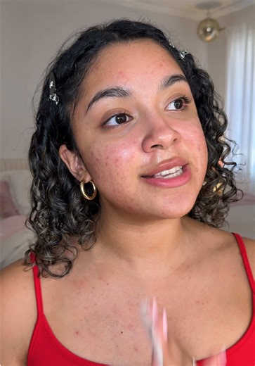 Embrace Self-Love: Daily Beauty Tips for Acne-Prone Skin