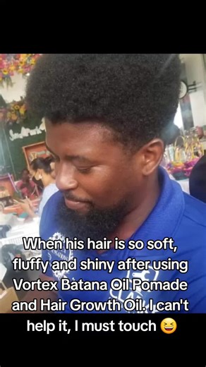 Incredible Hair Growth with Vortex Botanic Oil