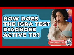 How Does The IGRA Test Diagnose Active TB? - Tuberculosis Disease Guide