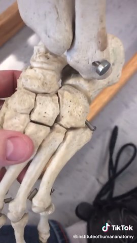 JONES FRACTURE!! These injuries can take months to heal, and sometimes they never fully heal.. #bonebreak #injury #foot #anatomy #humanbodyfacts