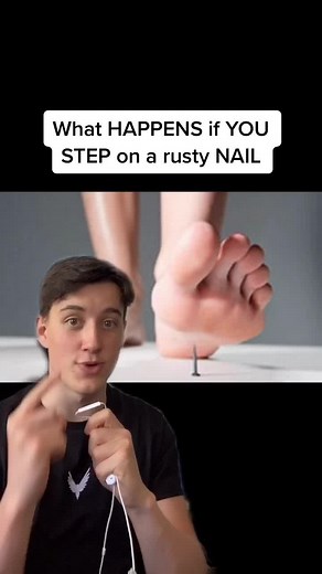 What HAPPENS if YOU STEP on a rusty NAIL 😱 #fyp #gasp #smart #facts #nail