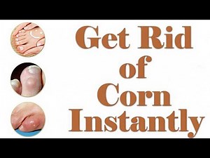 Corn Treatment - How to Get Rid of Corn on Foot - Corn Removal