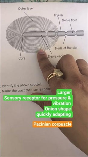 pacinian corpuscle -Sensory receptor. lateral spinothalamic tract carries pain and temperature