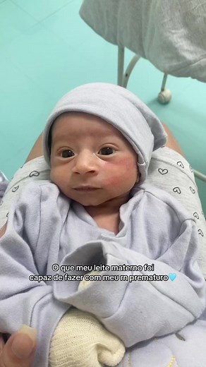 Leite materno para RN prematuro: o que aconteceu com meu filho