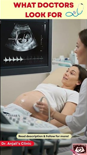 12-Week Dating Scan: Calculating Your Due Date (EDD) #shorts