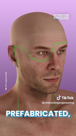 World's First Face and Eye Transplant Using Advanced Technology