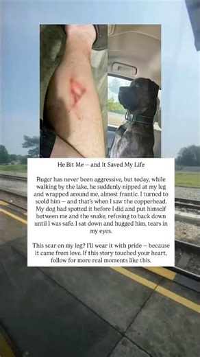 He Bit Me… But Saved My Life from a Snake