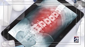 Houston doctors are using a new medical device to combat pain. KPRC2 Haley Hernandez shows you how it's helping patients without the need for pills. | KPRC2 / Click2Houston