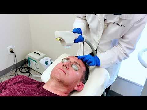 BBL Forever young laser treatment for Pigmentation on Skin