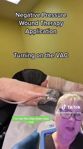 REVIEWING this negative pressure wound therapy application (Vac Dressing) 👍 #nurse #student #education #negative #wound #pressure #vac #dressing