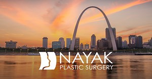 Deep Plane Facelift St. Louis, MO | Dr. Nayak