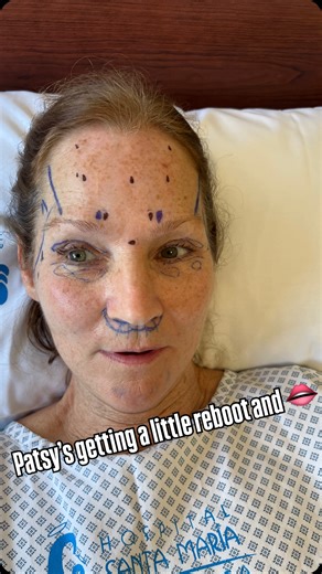 @peggylynnmarchetti on Instagram: "The big news is Patsy is getting a little reboot on her facelift she had in 2024 state side. We are in Guadalajara Mexico. Can’t wait to see those #TwinFaceliftDiaries #GuadalajaraFacelift #MexicoFaceliftJourney #CosmeticSurgeryMexico #FaceliftAbroad #MedicalTourism #FaceliftOver50 #TwinJourney #FaceliftResults #AgelessStyle"