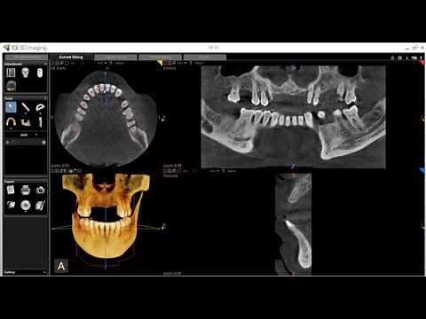 CS 3D Imaging Creating a Reconstructed Panoramic Image