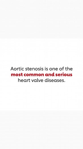 Aortic stenosis can lead to heart failure and death if it’s not treated. Find out more at heart.org/as. | American Heart Association