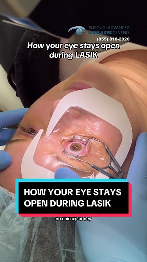 LASIK Eye Surgery: Steps, Vision Correction & Surgeon Insights