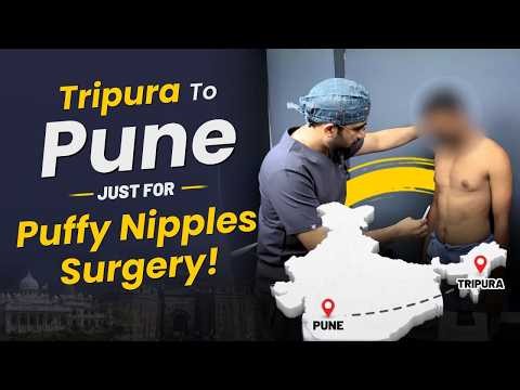 He Took A 2 Day Train Journey For Puffy Nipple Surgery! | Dr DC, Plastic Surgeon | Pune, India