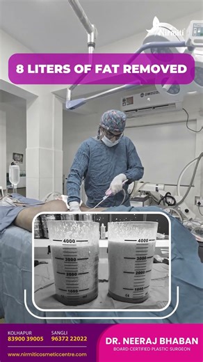 Back Liposuction: Smooth & Sculpted Back | Nirmiti Plastic Surgery