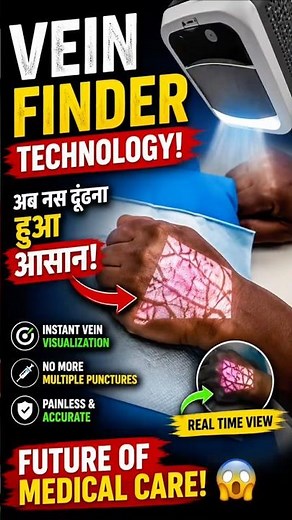 🎯 🔥 This Machine Shows Your Veins LIVE 😱 | Vein Finder Technology Explained