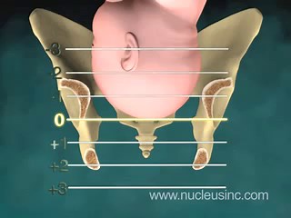 Geburt - DocCheck Flexikon