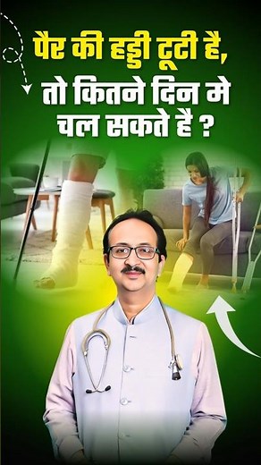 हड्डी टूटने के बाद कितने दिन में चल सकते हैं | bone fracture recovery time explained