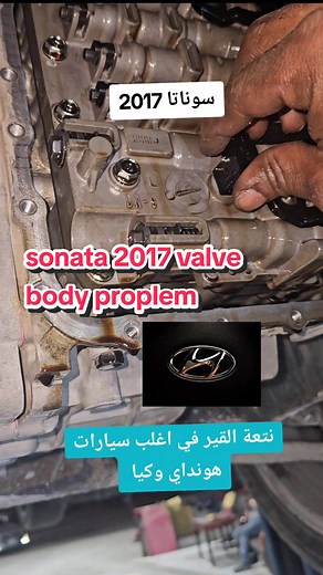 حل مشكلة نتعة قير هونداي سوناتا 2017