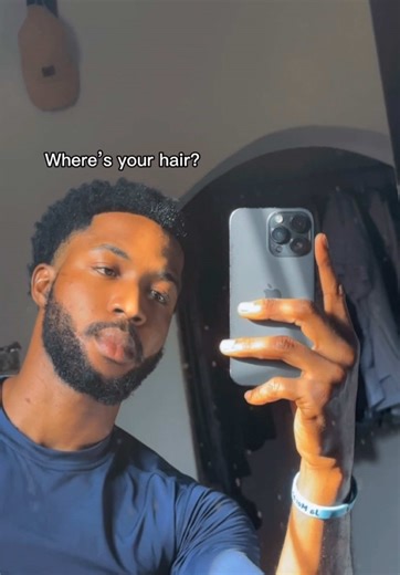 Creative CapCut Template for Hair Loss Moments