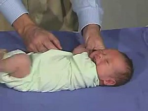 3.7 - Tone, Scarf Sign - Newborn Normal - Infant Clinical Examination(MRCP)