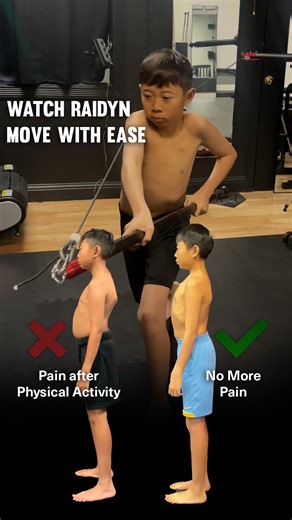 Functional Patterns on Instagram: "Raidyn was brought in by his mom in July 2024 looking for options after being advised by an orthopedist to use a hip/leg brace due to femoral anteversion, influencing an excessive anterior pelvic tilt. Raidyn had trouble running and found lateral movements challenging; always ending up with pain after physical activity. Raidyn completed 30 FP sessions with @claudia.e.ponce @fp.merced and during that time his gait sequencing improved significantly. Developing be