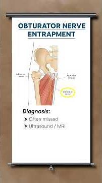 Obturator nerve entrapment - Diagnosis & treatment