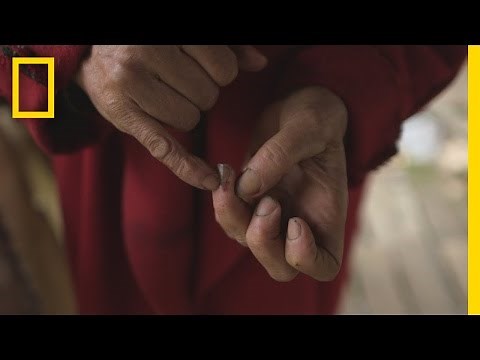 Treating Wounds | Live Free or Die: How to Homestead