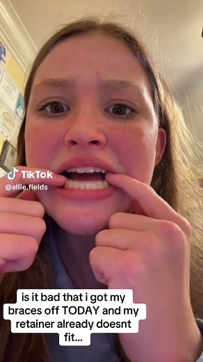 Getting Braces Off: What to Expect After Removal