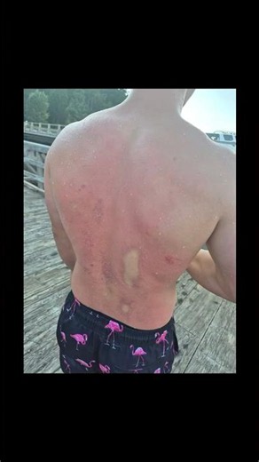 Two and a half backflips🙁 #flips #flip #tuff