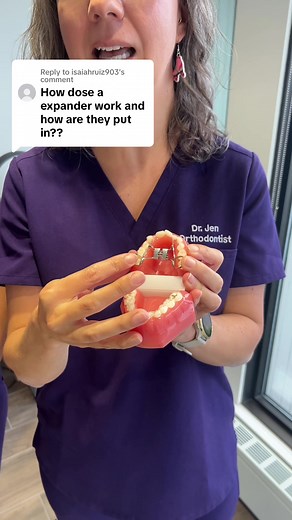 How to Use Expanders for Teeth: A Simple Guide