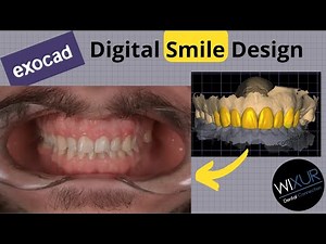 Digital Smile Design (Load Image)