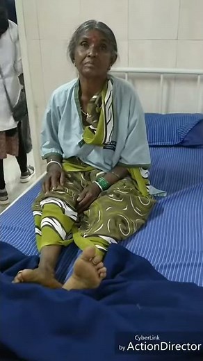 Faciobrachial dystonic seizure