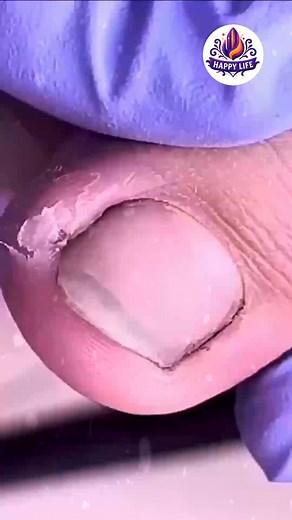 Ep.1615 Summer starter plan for cardiosmart routine 🌹💕 #CardioHealth #HeartHealthyDiet #SeasonalWellness | Health - Wellness