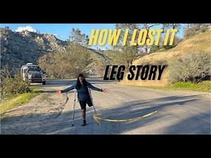 Amputation Story. Answering my Most Asked Question
