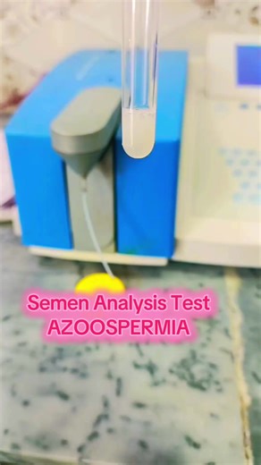 Semen Analysis Test.