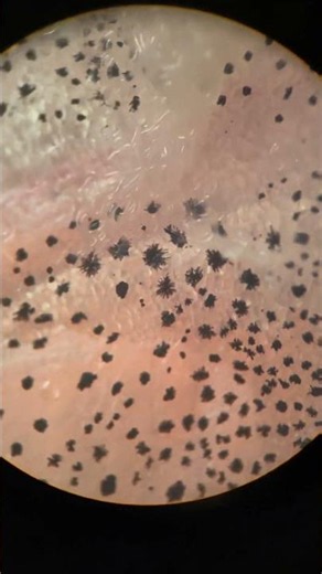 Fish Black Membrane, Unexpected Discovery, Freshwater Fish, Sushi