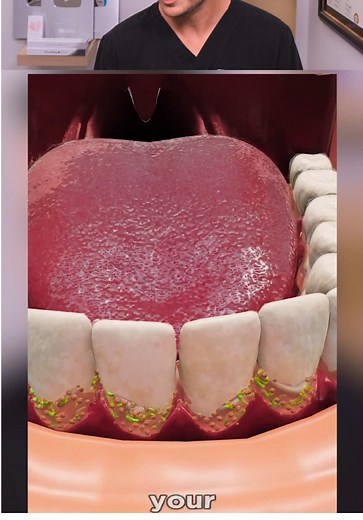 Effects of Not Brushing Teeth for a Year