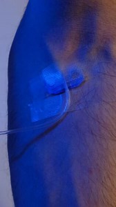 Download Bind Serum on Arm for free