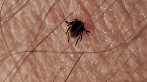 「ライム病の恐れがある人間の皮膚に埋め込まれた危険な昆虫の咬傷のマクロ」の動画素材（ロイヤリティフリー）3497015505 | Shutterstock