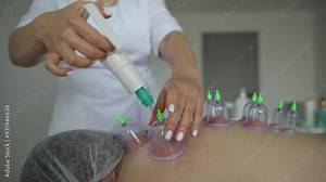 Therapist demonstrates cupping therapy on male and female patients