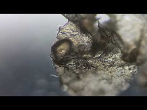 Dandruff under a microscope