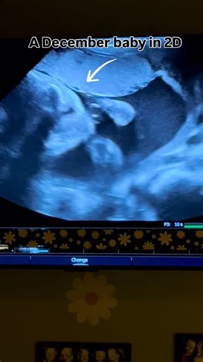 1.3K views | December babies are extra special—born in the heart of...