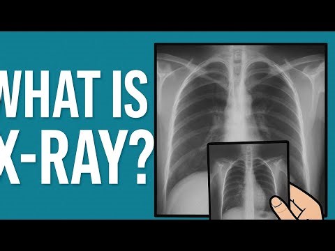 What is an x-ray - #medical #xray #viralvideo